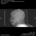 Guyana doctors save Cuban teenager after knife attack