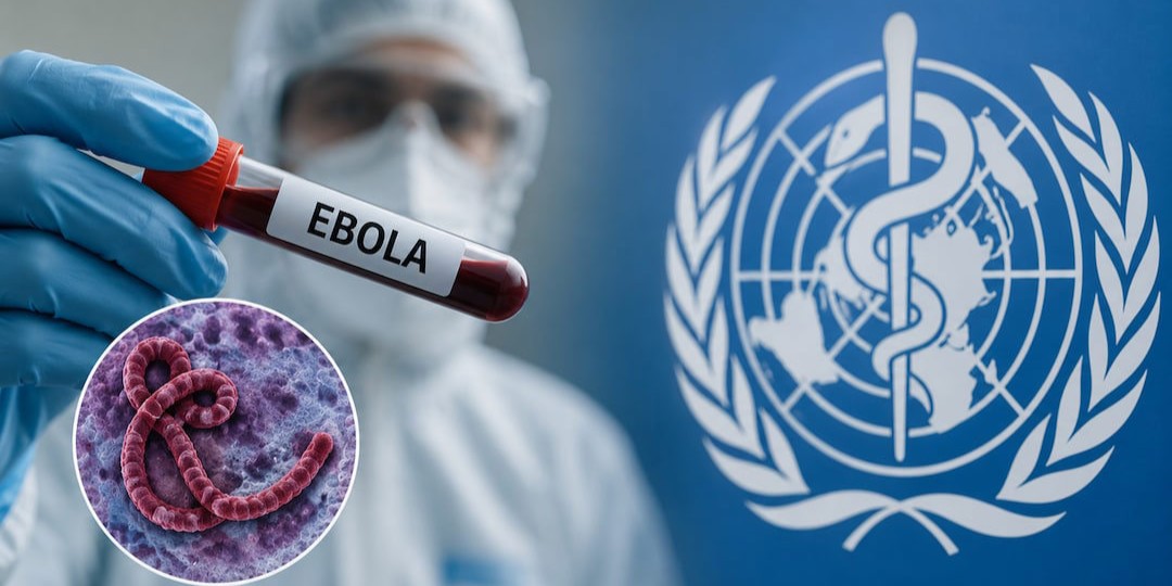 Ebola